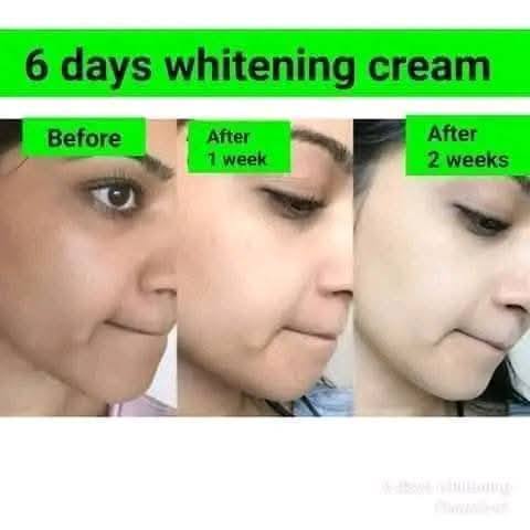 6 Days Whitening Cream - Natural Herbal Beauty Cream